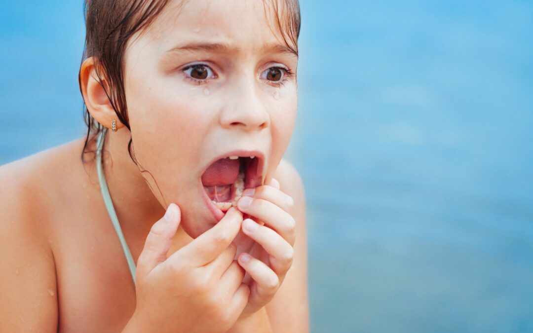 My Child Chipped a Tooth: What Should I Do?