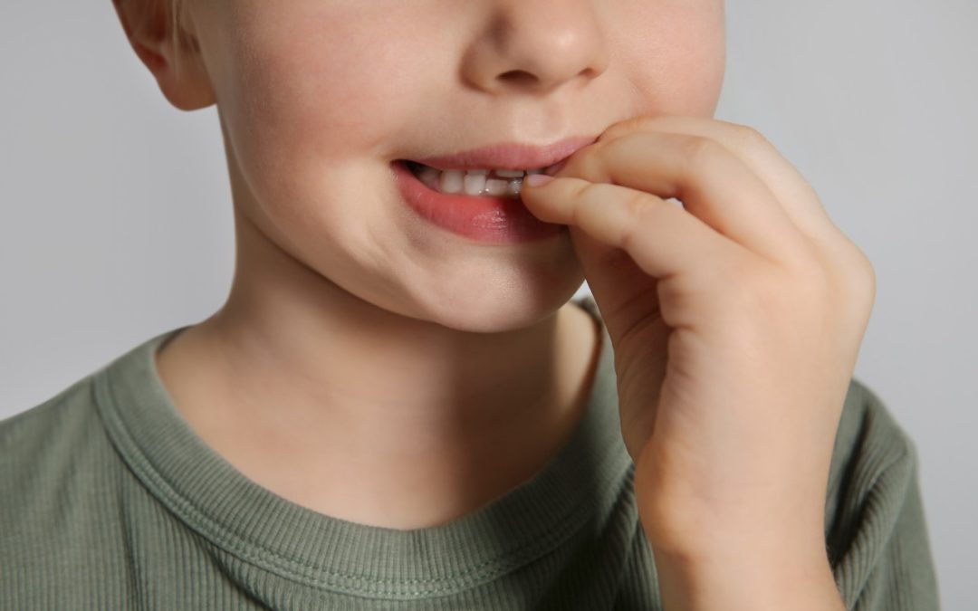 tooth discoloration in children grey tooth